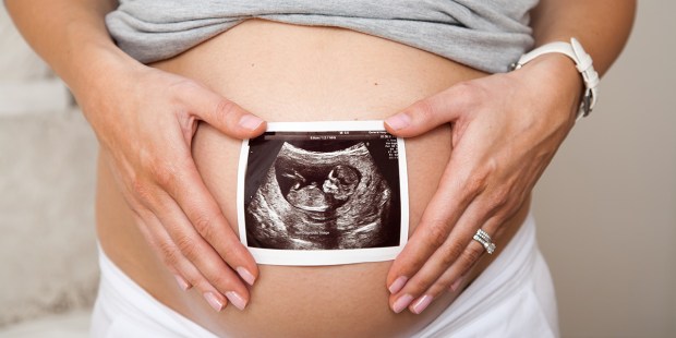 PREGNANT
